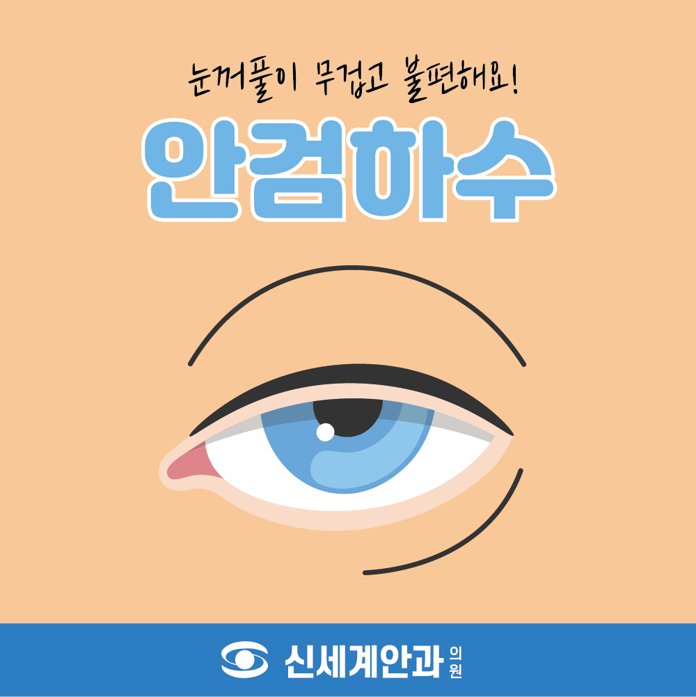 안검하수1.jpg